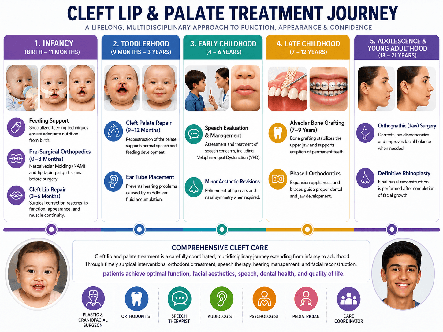 Cleft Lip and Palate Management