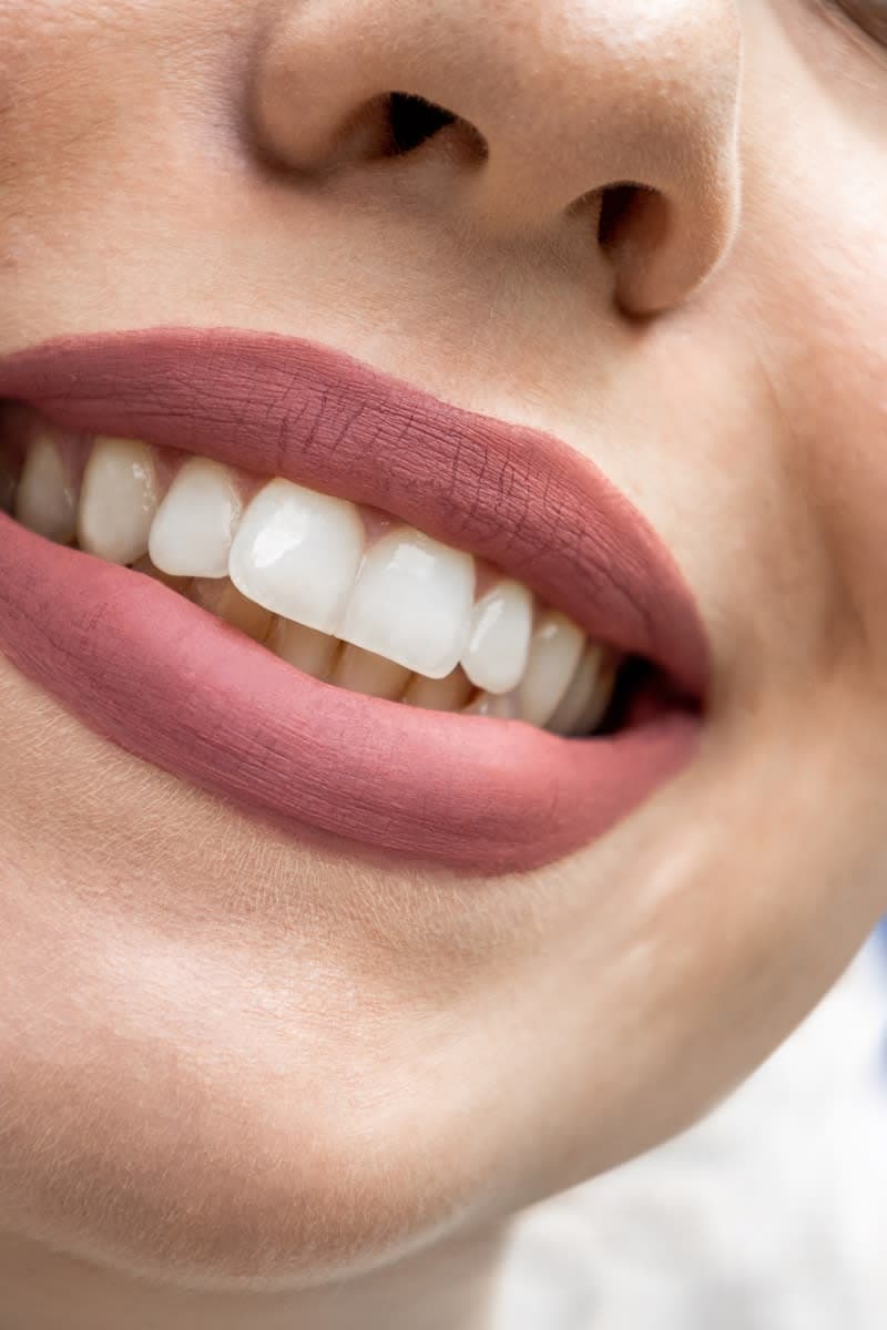 Cosmetic Dentistry | Digital Smile Designing